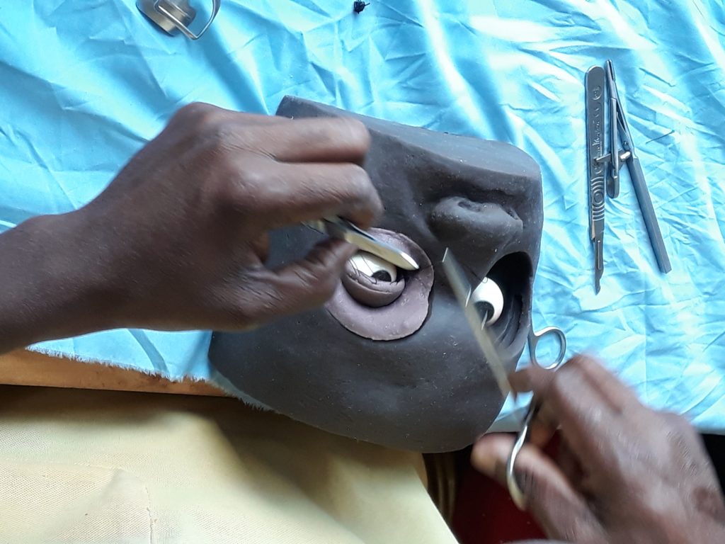 Evaluation of project to improve eye health and reduce avoidable blindness 